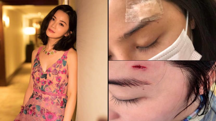 Charlene Choi sustains minor injury on head