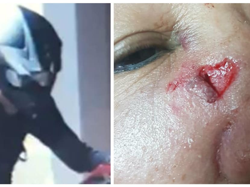 Elderly woman suffers multiple injuries after being hit by e-scooter Elderly woman suffers multiple injuries after being hit by e-scooter