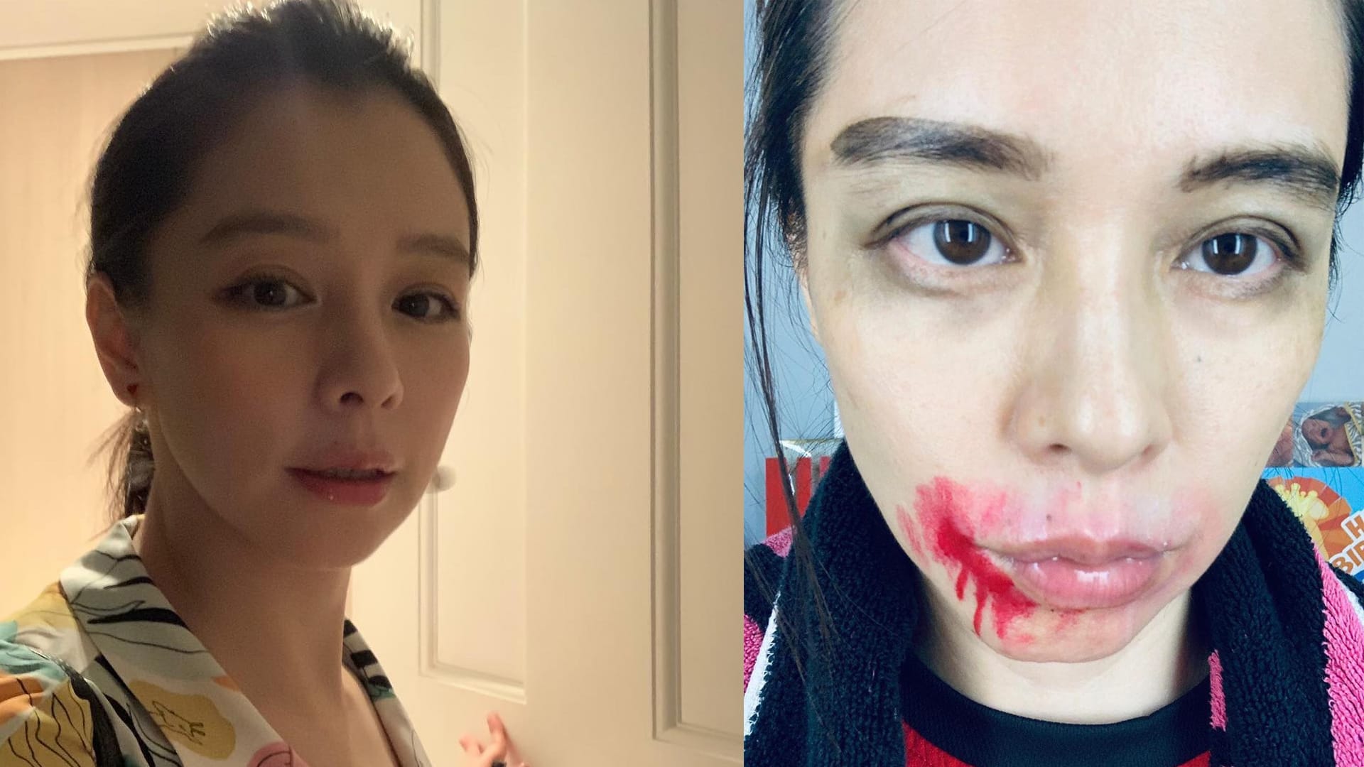 Vivian Hsu Is Not A Victim Of Domestic Violence, Despite What Her Recent Photo Suggests Vivian Hsu Is Not A Victim Of Domestic Violence, Despite What Her Recent Photo Suggests