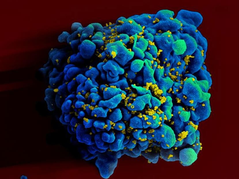 Scientists declare gene therapy method for HIV a success