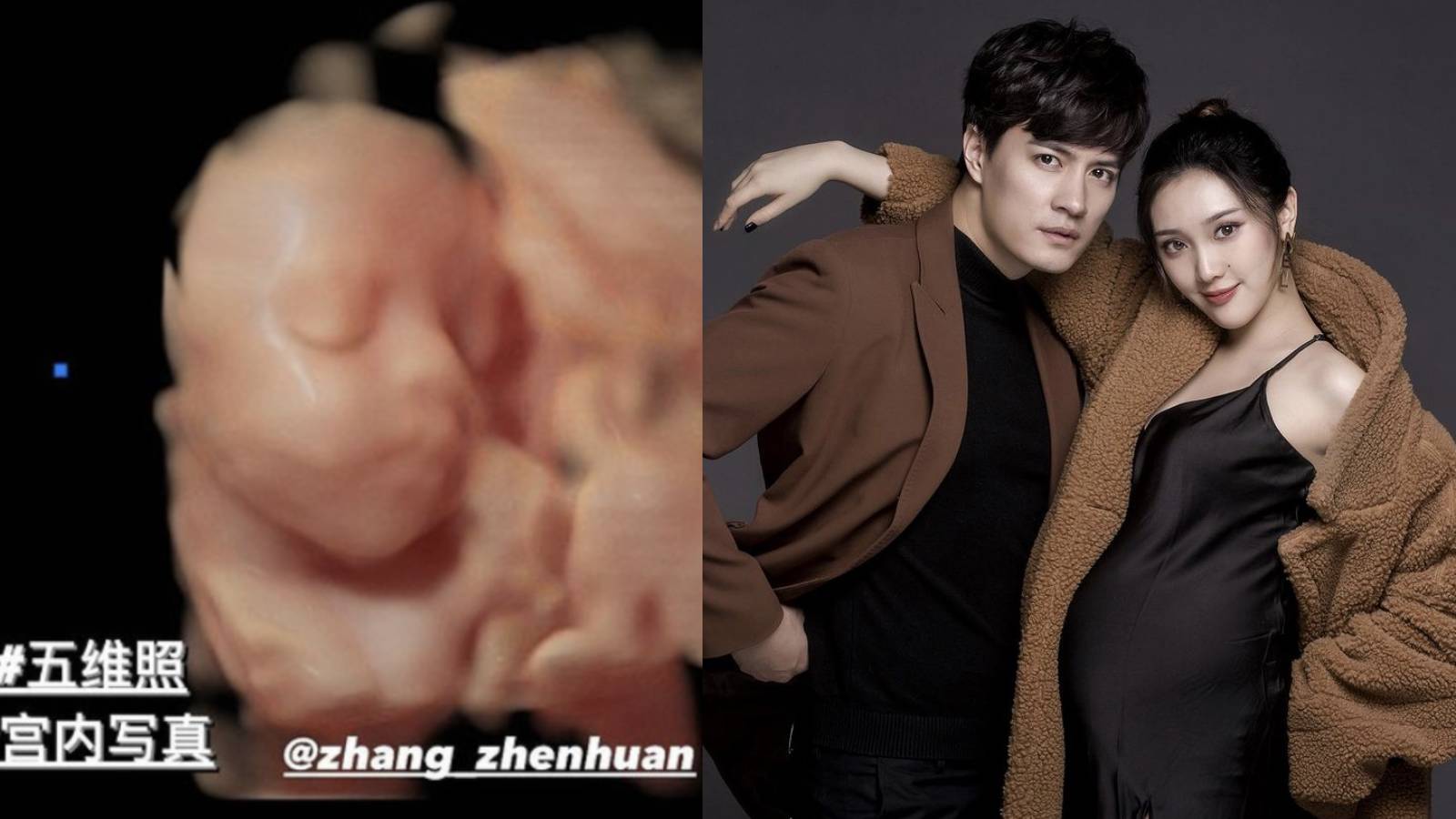 Zhang Zhenhuan’s Girlfriend— Or Is It Wife Now?— Posts Pic Of Their Baby's Ultrasound