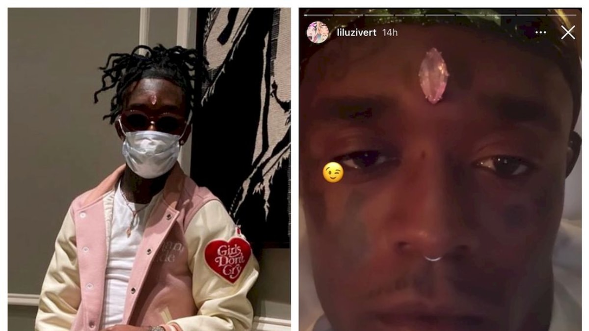 American Rapper Lil Uzi Vert Has Forehead Pink Diamond Implant Ripped Out By Fans Today 1386