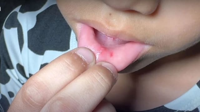 没人承认乱吐口香糖 泰国老师用针扎36名学生嘴巴