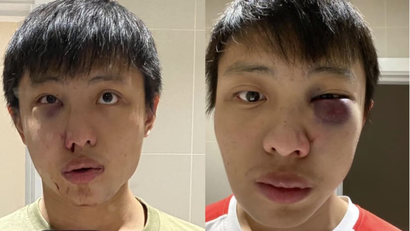 Singaporean student in London says he was assaulted after reacting to COVID-19 comments Singaporean student in London says he was assaulted after reacting to COVID-19 comments