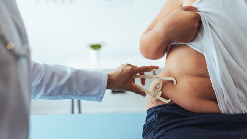 Obesity among children on the rise in Singapore, but fat-shaming is not the answer Obesity among children on the rise in Singapore, but fat-shaming is not the answer