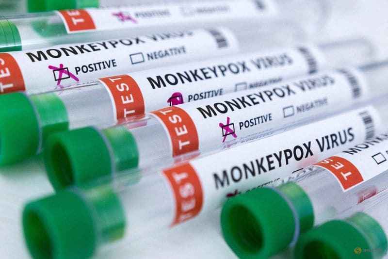 Monkeypox vaccine maker Bavarian Nordic ready to meet demand