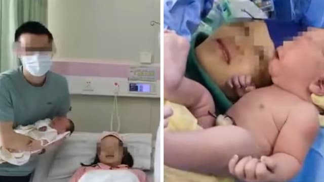 中国夫妻诞下“镜面宝宝” 概率仅百万分之一