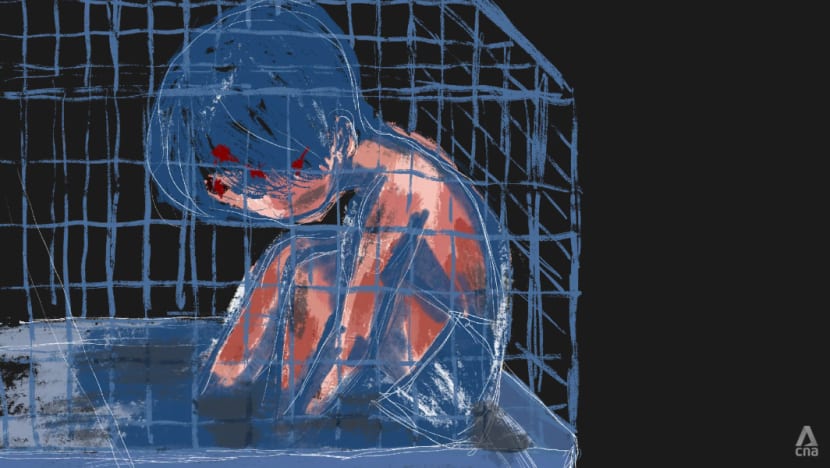 caged scalded boy interactive