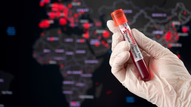 世界卫生组织针对猴痘疫情发布最高级别警报