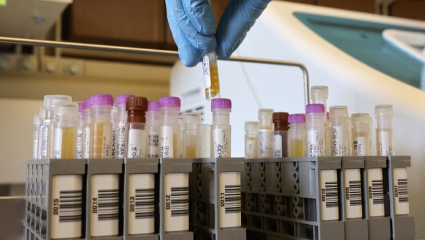 FAQ: What you need to know about Novavax's non-mRNA COVID-19 vaccine Nuvaxovid FAQ: What you need to know about Novavax's non-mRNA COVID-19 vaccine Nuvaxovid