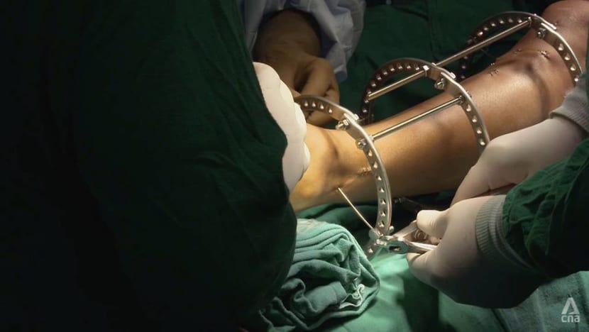 Is bone-breaking surgery to grow taller worth the risk? Is bone-breaking surgery to grow taller worth the risk?