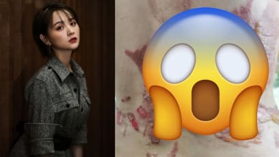 Yanxi Palace Actress Suffers Second-Degree Burns After Cupping Session Accident