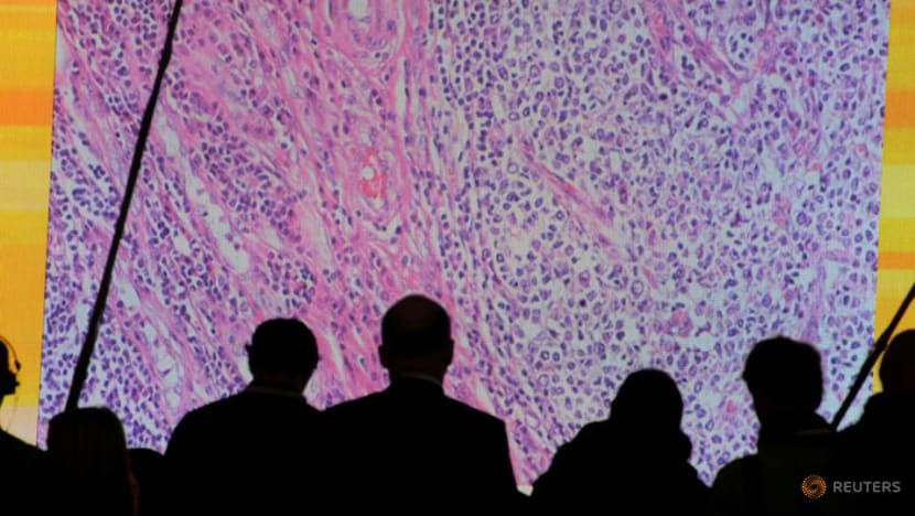 Cancer now 'leading cause of death' in rich countries Cancer now 'leading cause of death' in rich countries