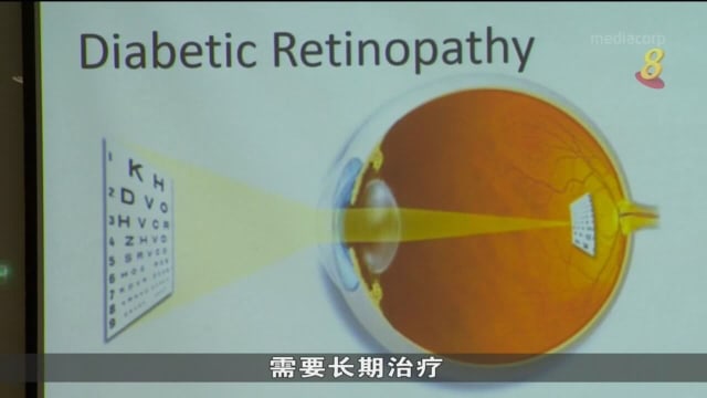 本地新药物获准使用 可治两种眼疾避免丧失视力