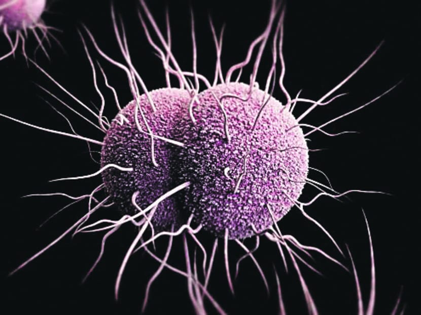 Antibiotic-resistant gonorrhoea spreads easily  and the symptoms are often missed. TODAY file photo