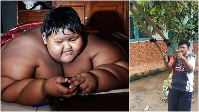 世界最胖小子三年狂瘦108公斤  如今爬树打球都行