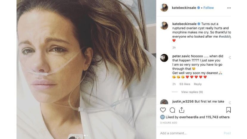 Kate Beckinsale hospitalised with ruptured ovarian cyst