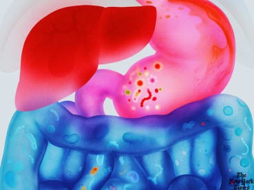 Will stress and spicy food give you stomach ulcers? Can you become too dependent on laxatives?