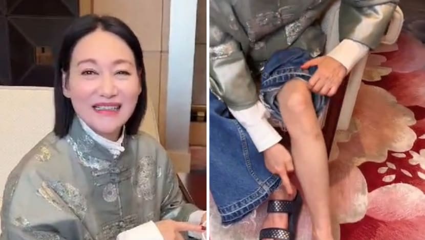Kara Hui Has To Take Blood Thinners After Having Heart Surgery, Says She Now Gets Bruises With The Slightest Touch