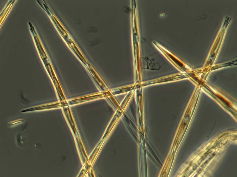 In this undated handout microscopy photo provided by NOAA Fisheries, the algae pseudo-nitzchia, which produces the toxic domoic acid, is seen from an algae bloom sample that the NOAA ship Bell M Shimada collected during its survey this summer on the West Coast. Photo: AP