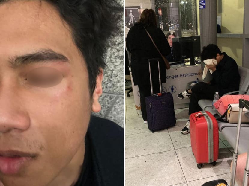 The victims suffered bruises and a black eye after they were assaulted by a group of teenage boys in an unprovoked attack in Dublin, Ireland on Dec 4, 2022. The victims suffered bruises and a black eye after they were assaulted by a group of teenage boys in an unprovoked attack in Dublin, Ireland on Dec 4, 2022.