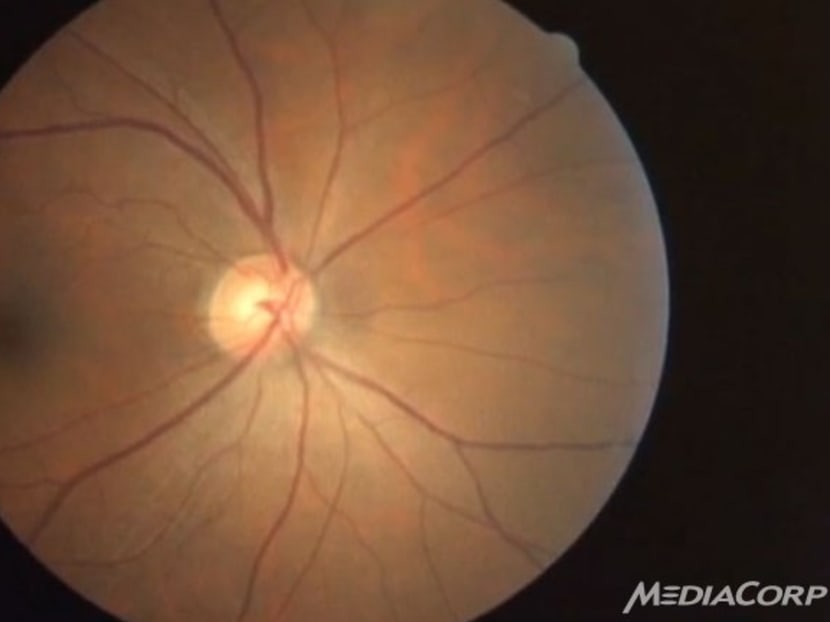 Retinal imaging may help assess pregnancy TODAY
