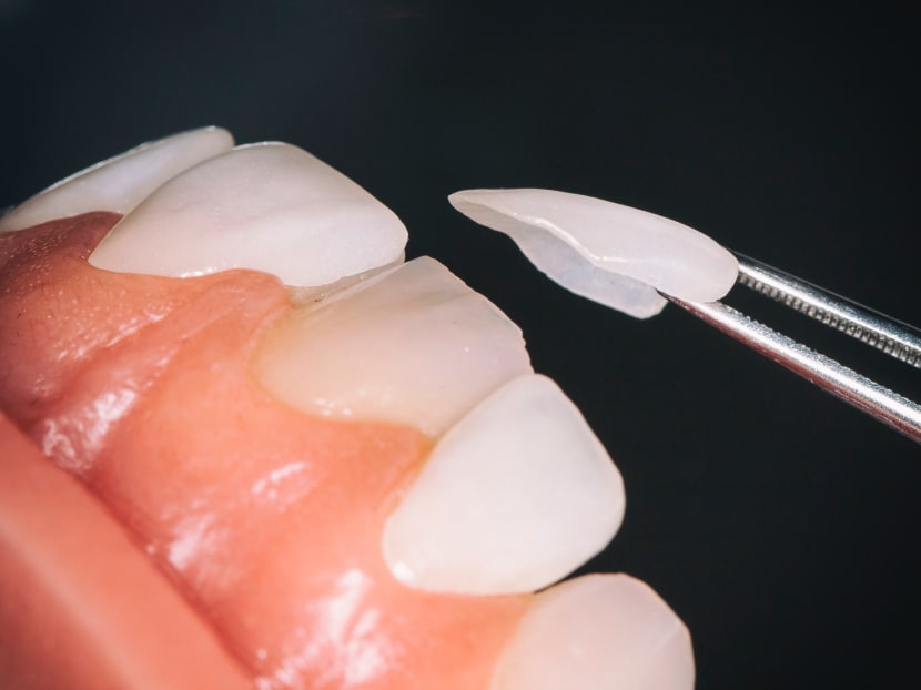 Up to 72 patients at the National Dental Centre Singapore received treatment with instruments that did not go through the final step of disinfection, said the centre. Photo: unsplash.com Up to 72 patients at the National Dental Centre Singapore received treatment with instruments that did not go through the final step of disinfection, said the centre. Photo: unsplash.com