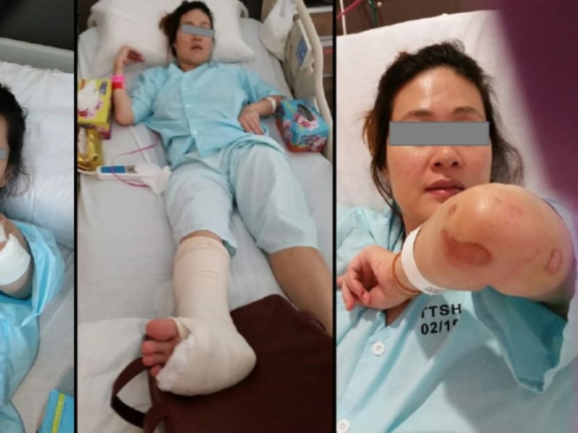 Ms Chan Hui Peng pictured in hospital after she fell into a manhole.