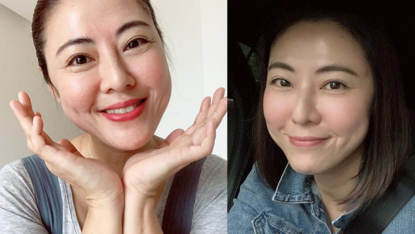 Cynthia Koh, Who Is Now Selling Skincare Products, Had Such Bad Acne, She Was Told She Had No Good Angles