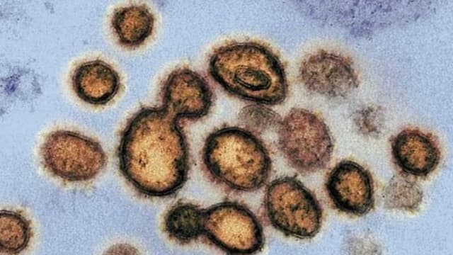 【冠状病毒19】研究：SARS抗体能阻断冠病