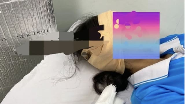 上体育课后被飞刀刺穿太阳穴 越南女学生仅受轻伤
