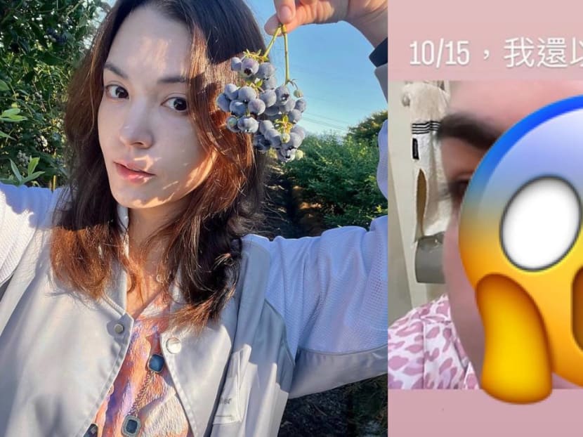 Taiwanese Actress Sandrine Pinna Had An Allergic Reaction So Bad, It Made Her Face Resemble "A Pig's Head"