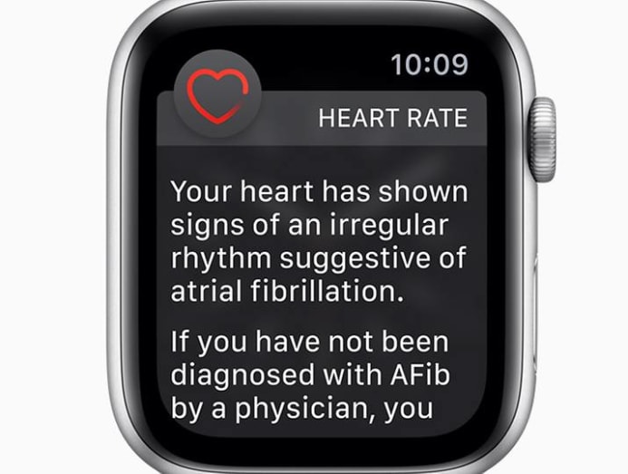 Irregular heart 2025 rhythm apple watch