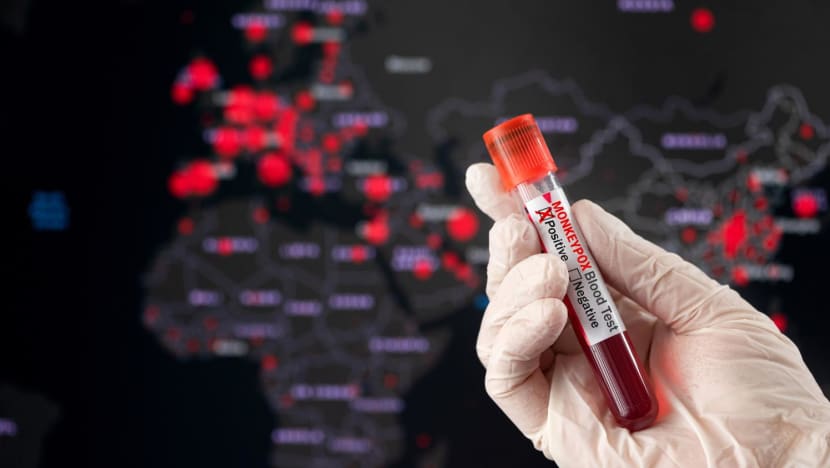 Singapore reports 11th case of monkeypox infection since June Singapore reports 11th case of monkeypox infection since June