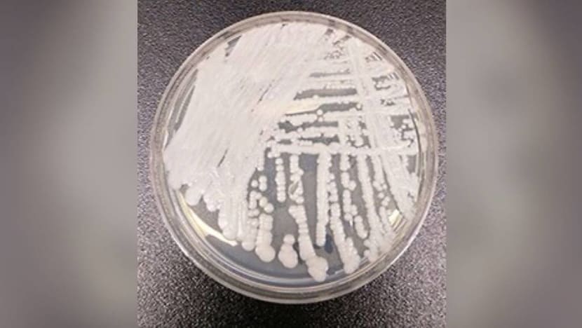 11 cases of Candida auris reported at Singapore public hospitals since 2012