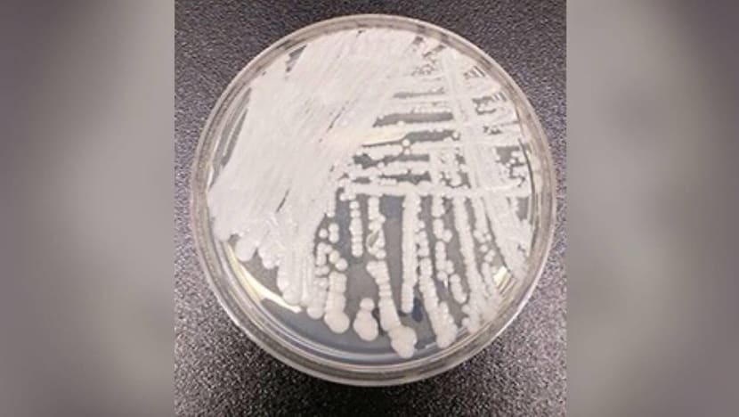 11 cases of Candida auris reported at Singapore public hospitals since 2012 11 cases of Candida auris reported at Singapore public hospitals since 2012