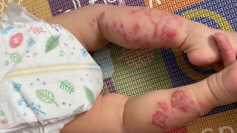 Commentary: A slice of bread could kill my child Commentary: A slice of bread could kill my child