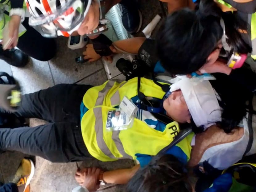 Ms Veby Mega Indah, an associate editor at Suara Hong Kong News, was on Sunday (Sept 29) struck in the face by a non-lethal round fired by police.