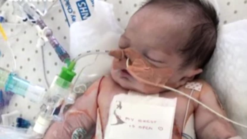 Bayi 9 bulan terkena 25 serangan jantung dalam tempoh sehari
