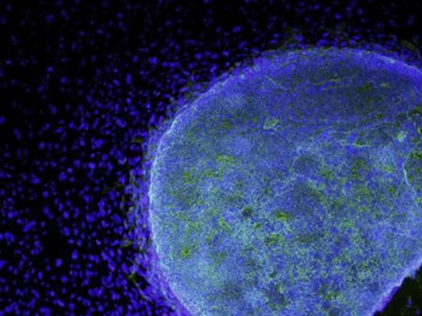 A microscopic view shows a colony of human embryonic stem cells (light blue) growing on fibroblasts (dark blue) on March 9, 2009. Photo: Reuters