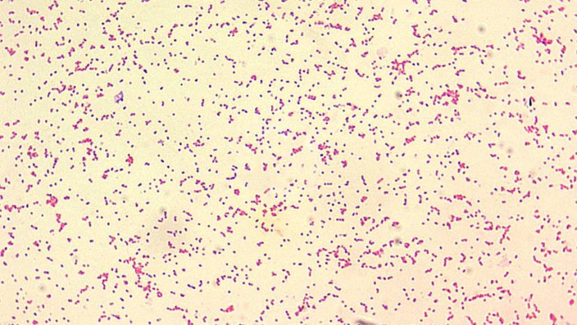 Thousands in China test positive for bacterial disease after leak from biopharmaceutical plant last year Thousands in China test positive for bacterial disease after leak from biopharmaceutical plant last year