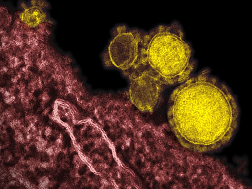 A electron microscope image showing the MERS virus (in yellow). Two Indonesian men were suspected to have died from the virus this week. PHOTO: AP