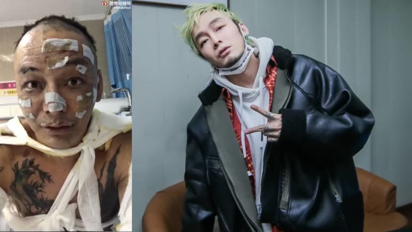 Chinese Rapper Suffers 2nd Degree Burns On 40% Of His Body After He Fell Asleep Without Putting Out A Scented Candle
