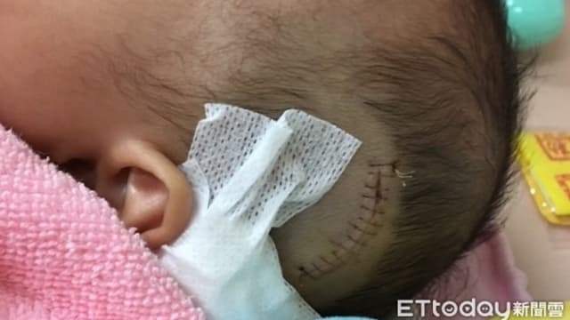台湾六个月大男婴遭抛摔缝20针 保姆判监四个月