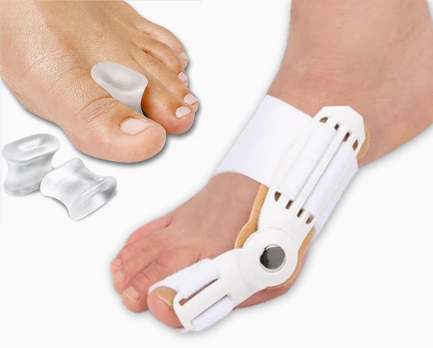 Bummed out over bunions: Do toe spacers and splints actually help relieve  pain and swelling? - CNA Lifestyle