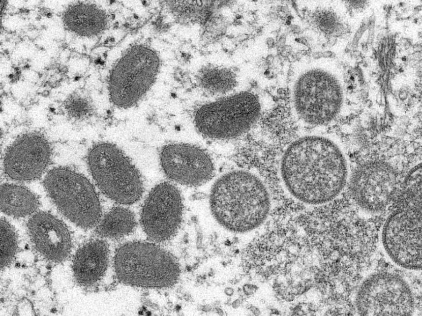 No monkeypox infections detected in Singapore since imported case in 2019: MOH No monkeypox infections detected in Singapore since imported case in 2019: MOH