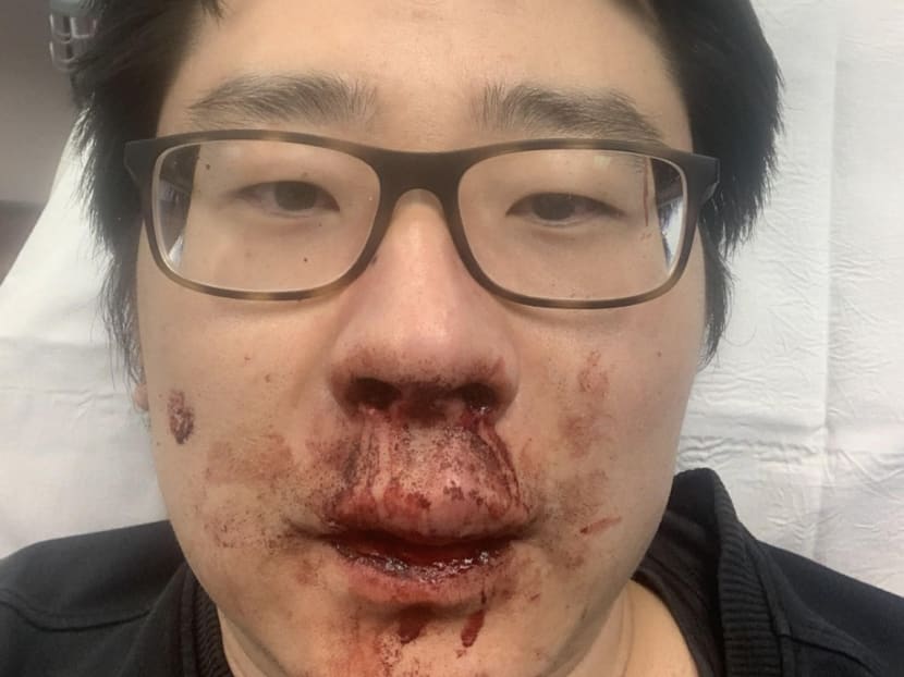 Lecturer Peng Wang suffered a bloody nose and bruises to his face after he was attacked in the British city of Southampton last week.