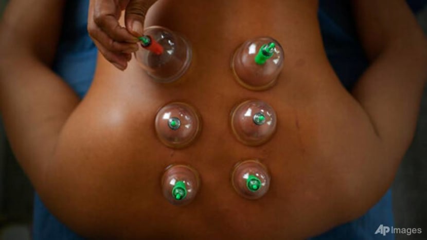 TCM practitioner suspended for causing burns to patient during fire cupping treatment TCM practitioner suspended for causing burns to patient during fire cupping treatment