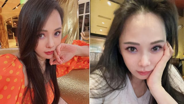 认动用医美　伊能静：这很正常