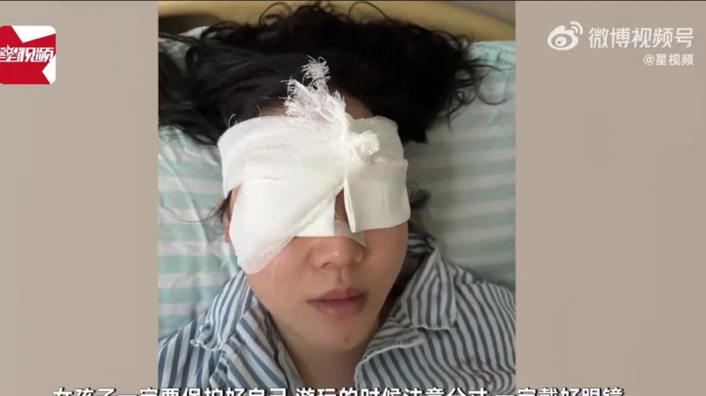 泼水节被高压水枪射伤 中国游客眼睛一度失明